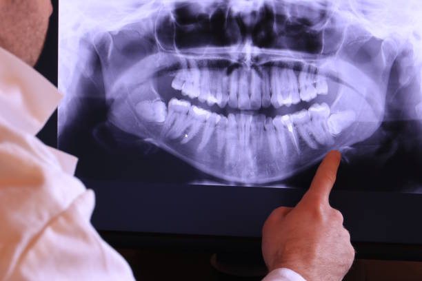 Best Emergency Treatment for Dental Infections or Abscesses in Lake City, AR